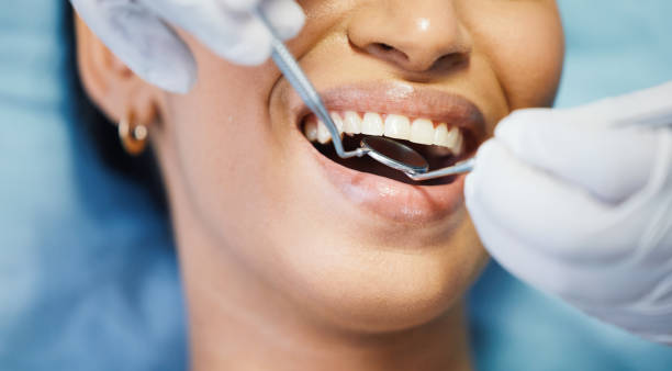 Best Emergency Root Canal Treatment in Arlington Heights, WA