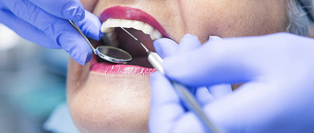Best Emergency Dentist for Lost Fillings or Crowns in Arlington Heights, WA